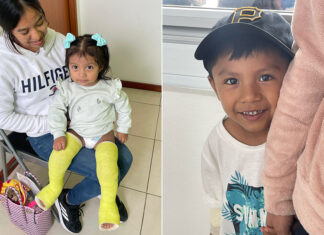 Americans making a positive impact in Mexico: Our CEO talks with Dr. Billy Andrews of Kids First Orthopaedics Two children, patients of Kids First Orthopaedics, smile at the camera. One little girl has casts on both legs. The other, a little boy, hides behind his mother